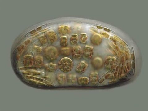 diatoms in a drop of water