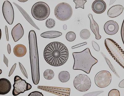 Diatom arrangement under a microscope