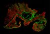 Mapping Aortic Valve Cells Using the FLUOVIEW FV3000 Microscope