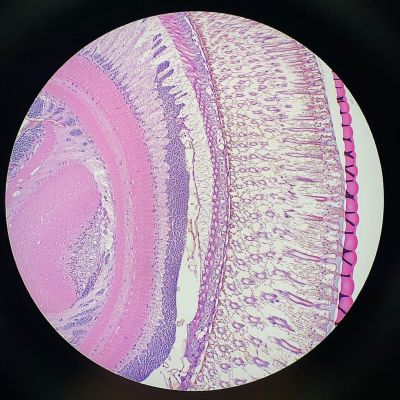 Facettenauge unter dem Mikroskop