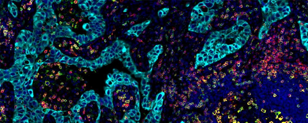 A la vanguardia del escaneo de portaobjetos: Fenotipificación de una sola célula en muestras fijas